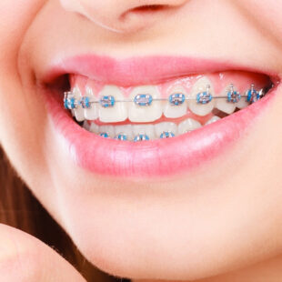 Orthodontics